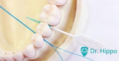 全面口腔護(hù)理指南 從清潔牙齒到整體健康